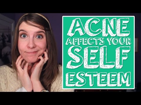 How Acne Affects Your Self Esteem