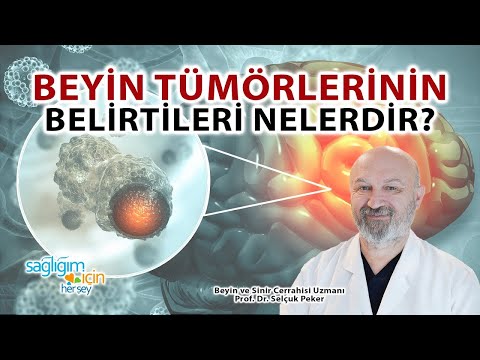 Beyin Tümörlerinin Belirtileri