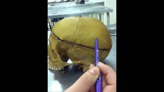 Osso Parietal - Odonto Unisa 2012