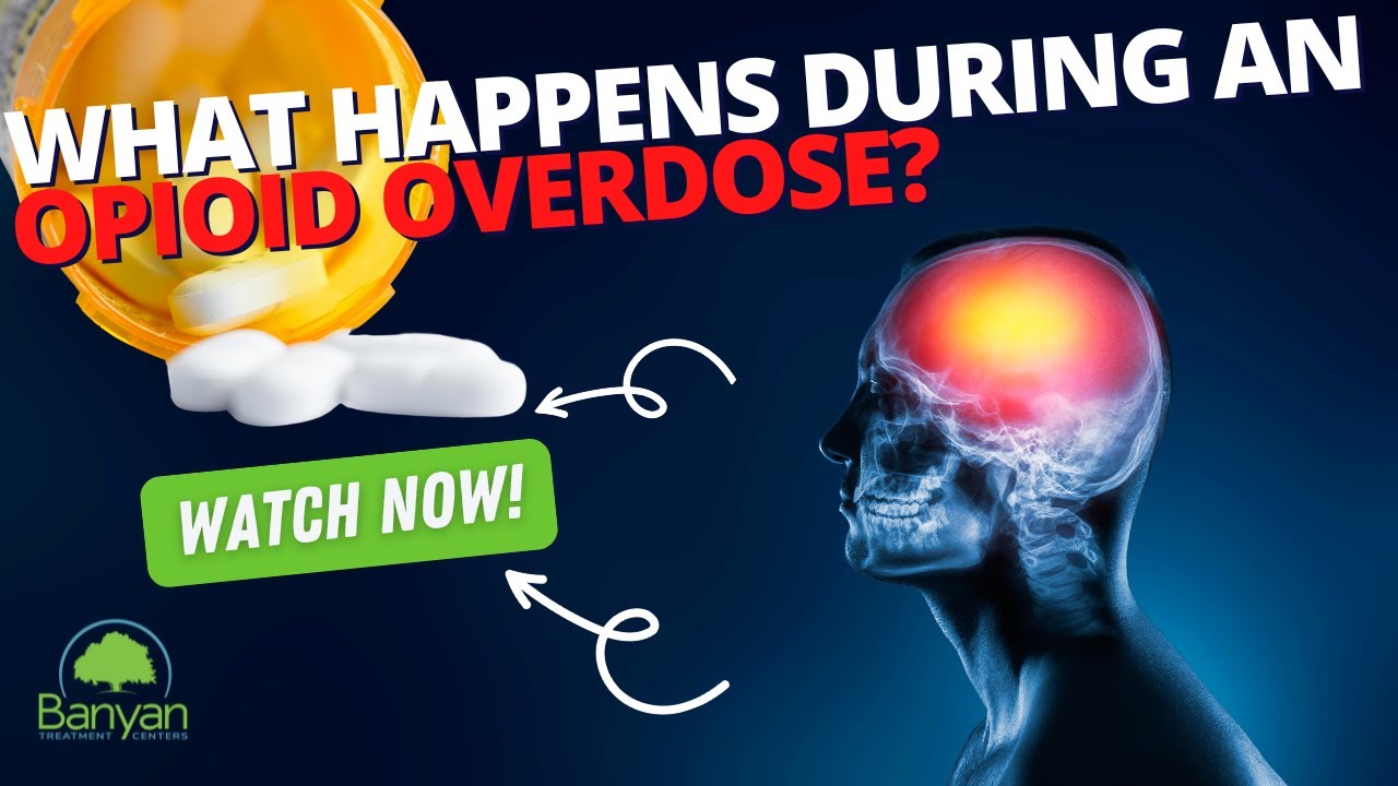 What Happens During An Opioid Overdose YouTube what-happens-during-an-opioid-overdose-youtube