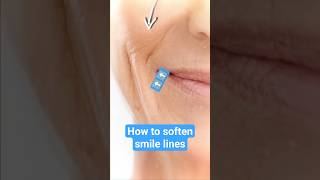 How To Soften Smile Lines
