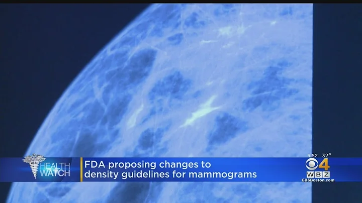 FDA Proposing Changes To Density Guidelines For Mammograms