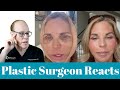 Facelift and eyelid surgery journey  plastic surgeon reacts