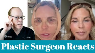 Facelift and Eyelid Surgery Journey | Plastic Surgeon Reacts