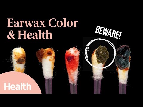 Your Earwax Reveals WHAT About Your Health? Here's What Your Earwax Color Could Mean | Deep Dives