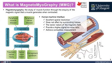 Integrated Pico-Tesla Resolution Magnetoresistive Sensors for Miniaturised Magnetomyography