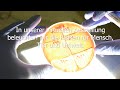 BUKO: virtuelle Ausstellung zu Antibiotikaresistenz (Trailer)