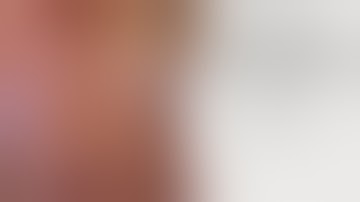 How to do a laparoscopic sigmoid colectomy/ high anterior resection ? Step by step. Dr S Anwar