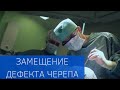 Современная технология замещения дефекта черепа