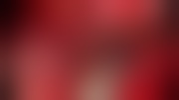 Uniportal VATS non grasping left subcarinal lymph node dissection (non edited surgery)