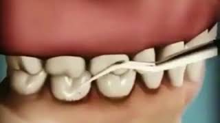 Проф. чистка зубов в INNOVASTOM