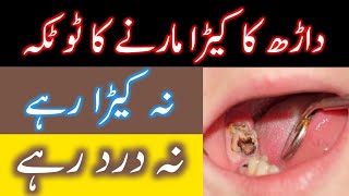 Danto kay keeray ka ilaj || Darh ki khor ke dard ka ilaj || Tooth decay treatment | Tooth cavity