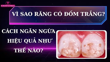 Vì sao răng có đốm trắng , cách ngăn ngừa | Tt Niềng Răng quốc tế Diamond