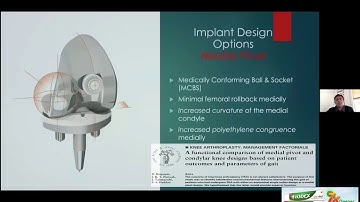 OrthoTV Original  - Kinematic Alignment vs Kinematic Implants - Dr Savyasachi Thakkar