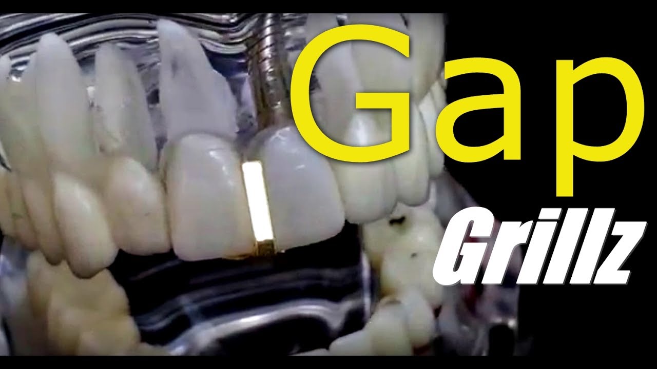 Gap Grillz Gold Plated Plain Tooth YouTube