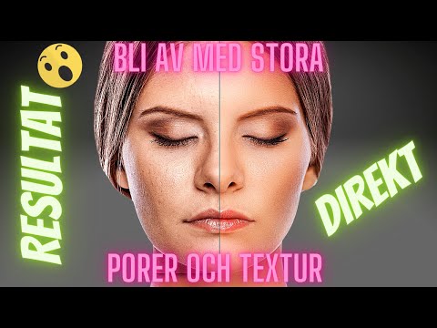 Video: Hur Man Blir Av Med Stora Porer: 8 Sätt