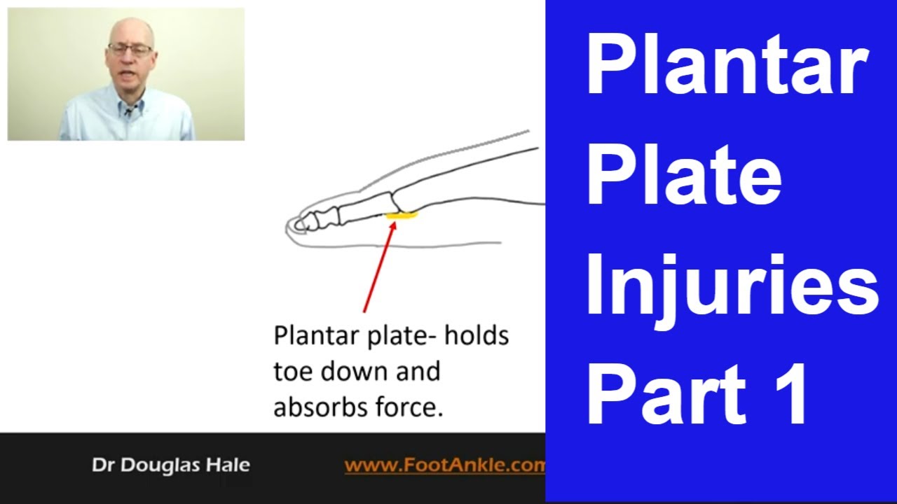 Травмы подошвенной пластины – Часть 1 | Подолог из Сиэтла