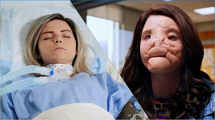 A mother saves another girl using her brain-dead daughter's face |The Good Doctor