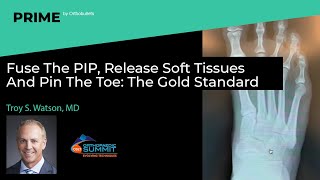 Fuse The PIP, Release Soft Tissues And Pin The Toe: The Gold Standard - Troy S. Watson, MD screenshot 1