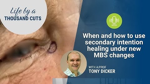 When and how to use secondary intention healing under new MBS changes