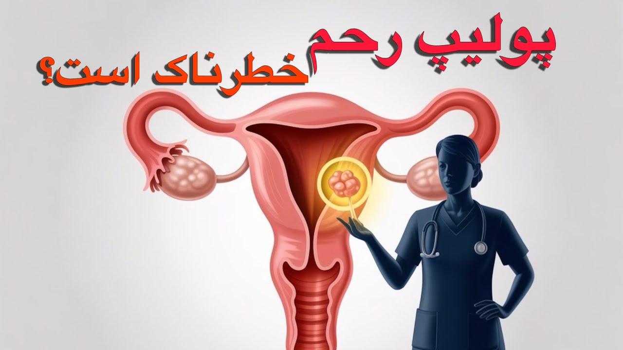 پولیپ رحم چیست؟ علائم، علت و درمان + آیا باعث نازایی می‌شود؟