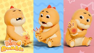 Boo Boo Song Ouch Rumble Got A Boo Boo Boo Boo Song In The Garden Nursery Rhymes For Kids