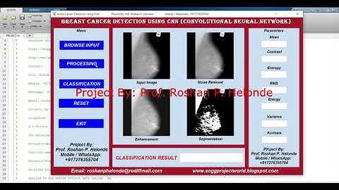 Breast Cancer Detection Using CNN | With Source Code | Matlab Project Breast Cancer Classification