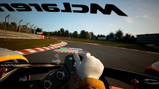 On september 20, 2017, uk's famed f1 constructor and leading sports
car brand mclaren has revealed the 'mclaren ultimate vision gran
turismo', a new to b...