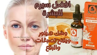 فيتامين سي oz natural || الفيتامين السحري لنضارة البشرة