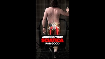 Address Your SCIATICA with Functional Patterns