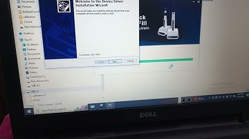 How to Install Nanopix Sensor #dental #everyone #eighteeth