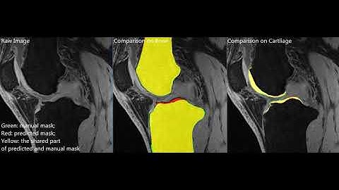 Knee joint segmentation based on data from grand challenge