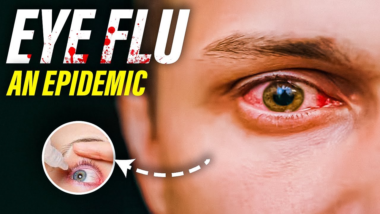 Conjunctivitis: What The Research Tells Us About Pink Eye and The Most Common Symptoms