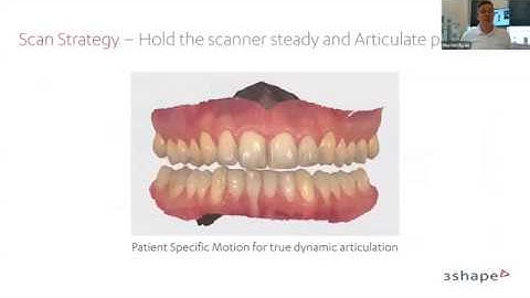 Tips & Tricks for optimal TRIOS Scanning, Morten Ryde webinar