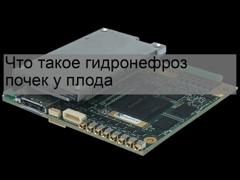 Что такое гидронефроз почек у плода