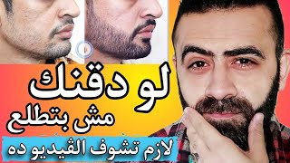 زراعة اللحية و تكثيف اللحية بسرعة خرافية - Beard Transplant