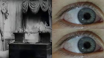 Trypanosoma Brucei Gambiense