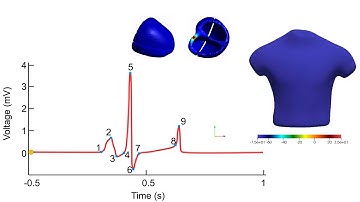 Body surface potential maps with heart activation simulation