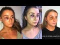 How To Cover A Black Eye & My Story | ELLA CROMEY