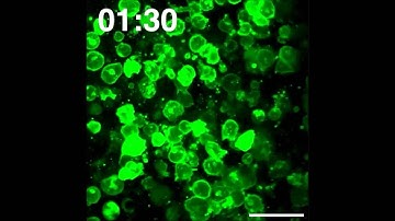 Visualization and tracking of tumour extracellular vesicle delivery and RNA translation using...