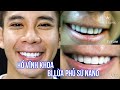 Sau khi bị lừa phủ sứ Nano, Hồ Vĩnh Khoa đi dán sứ Veneer và cái kết | White Dental