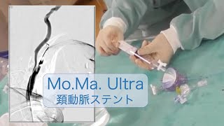 MOMA Ultraの使用手順；CAS