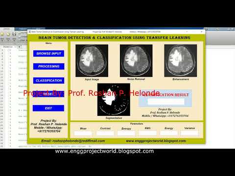 Brain Tumor Detection Using Transfer Learning | Matlab Project With Source Code Tumor Classification