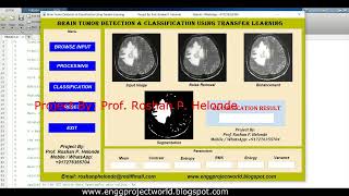 Brain Tumor Detection Using Transfer Learning | Matlab Project With Source Code Tumor Classification