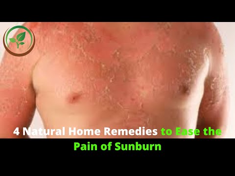 ✅ 4 Natural Home Remedies To Ease The Pain Of Sunburn || Natural Home Remedies for Sunburns