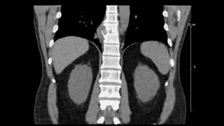 269 Hz : Spine Thoracic T9 (RIFE Healing Frequency)