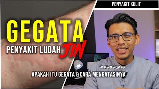 Gegata/ Sopak Garam : Betul Ke Disebabkan oleh Ludah Jin? Ubat dan Cara Menghilangkan Gegata
