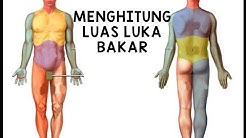Menghitung luas luka bakar - Durasi: 16.24. 