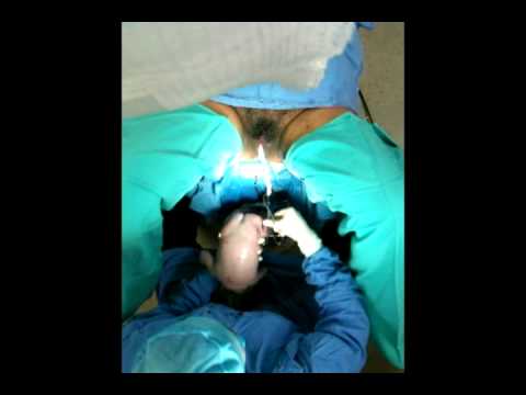 PARTO VAGINAL medicinal genomics