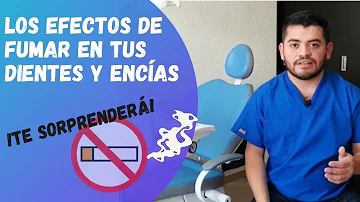 ¿Cómo fumar para no manchar los dientes?